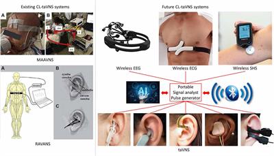 Closed-Loop Transcutaneous Auricular Vagal Nerve Stimulation: Current Situation and Future Possibilities